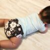 ウチの子、後頭部ハゲてる!?赤ちゃんの抜け毛の原因と対処法